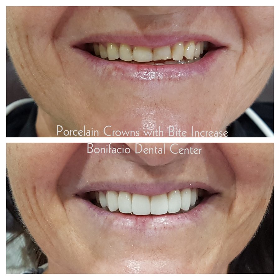 Bonifacio Dental Angeles City Dentist Pampanga PHP - Bonifacio Dental Angeles City Dentist Pampanga PHP