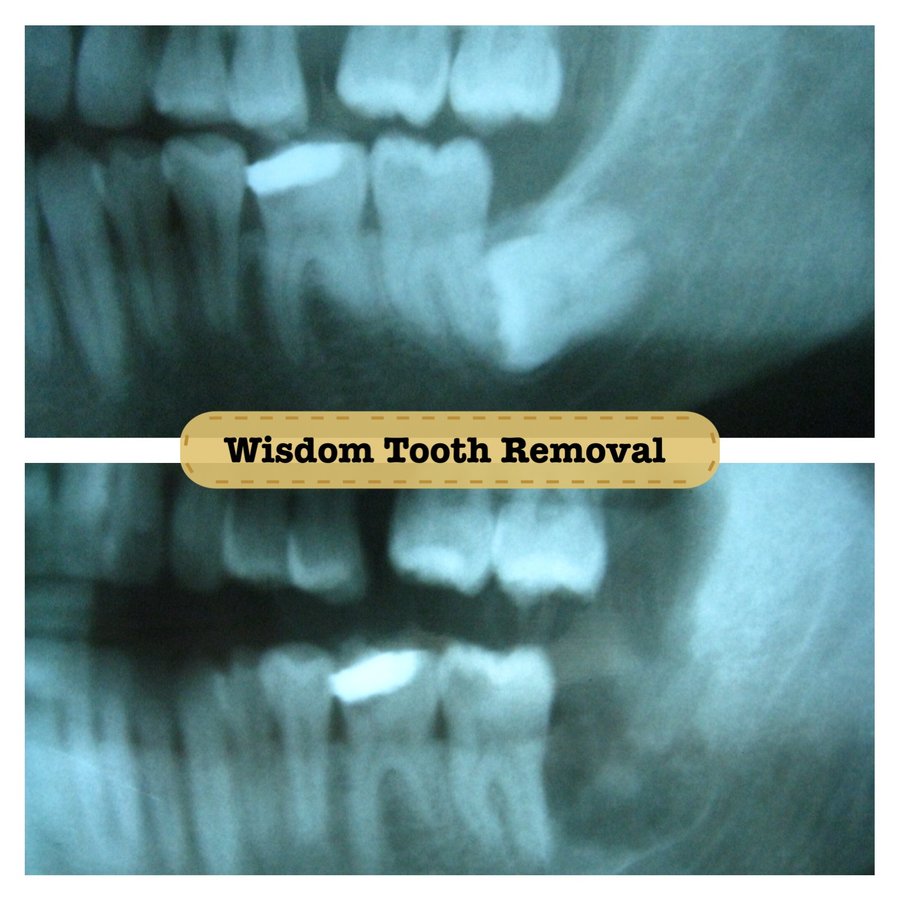 Bonifacio Dental Angeles City Dentist Pampanga PHP - Bonifacio Dental Angeles City Dentist Pampanga PHP