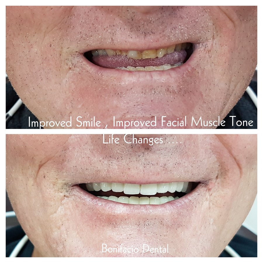 Bonifacio Dental Angeles City Dentist Pampanga PHP - Bonifacio Dental Angeles City Dentist Pampanga PHP