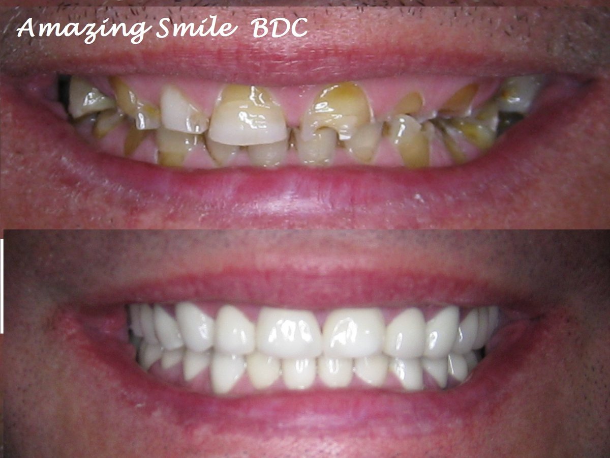 Bonifacio Dental Angeles City Dentist Pampanga PHP - Bonifacio Dental Angeles City Dentist Pampanga PHP