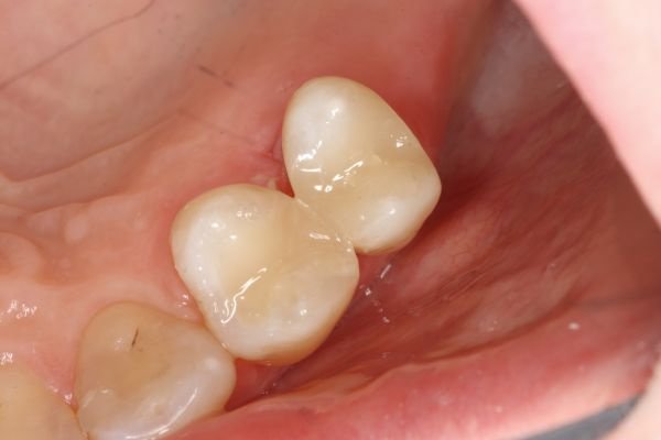 Botanics Dental Care - Botanics Dental Care