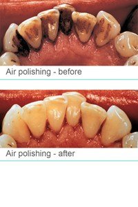 Botanics Dental Care - Botanics Dental Care