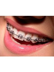 Braces Faces, Ankur Nursing Home - Braces Faces, Ankur Nursing Home