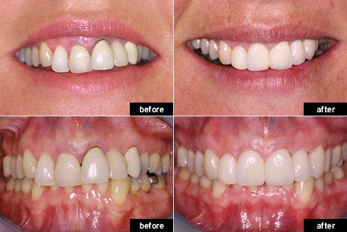 Bright Smile Dental Clinic - Bright Smile Dental Clinic