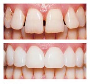 Bright Smile Dental Clinic - Bright Smile Dental Clinic