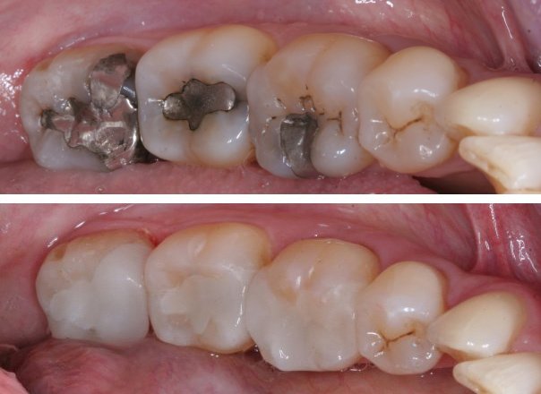 Bright Smile Dental Clinic - Bright Smile Dental Clinic