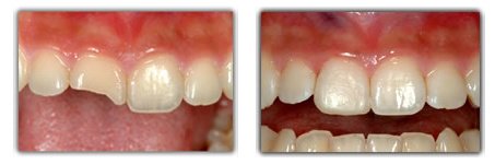 Bright Smile Dental Clinic - Bright Smile Dental Clinic