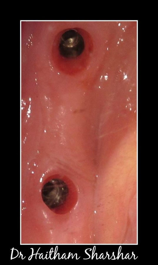 Bright Smile - Bright Smile