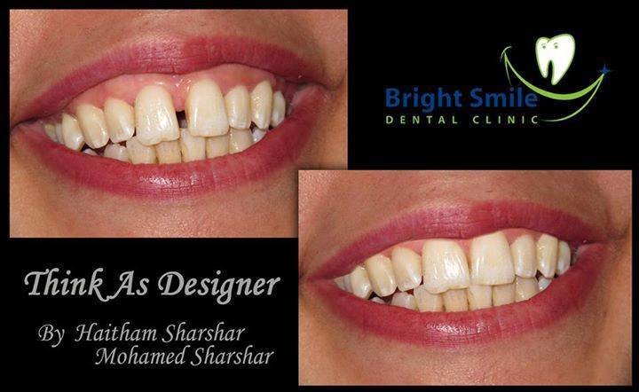 Bright Smile - Bright Smile