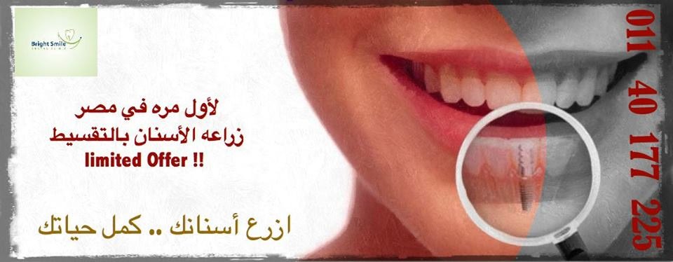 Bright Smile - Bright Smile