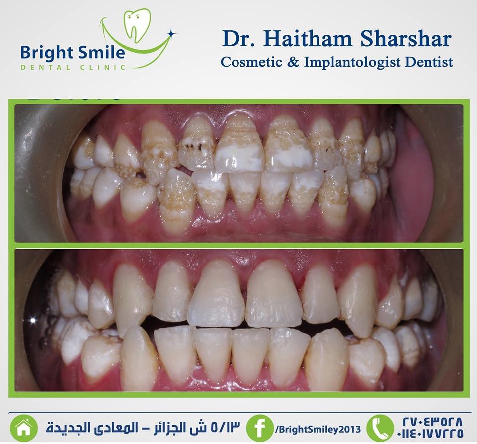 Bright Smile - Bright Smile