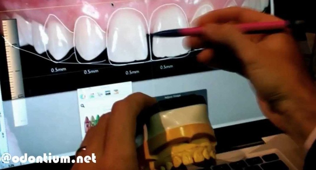 Bright Smile - Bright Smile