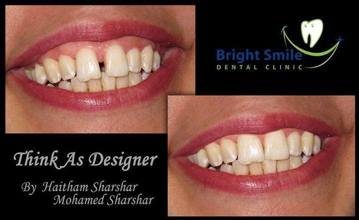 Bright Smile - Bright Smile