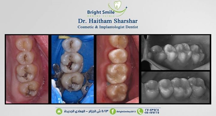 Bright Smile - Bright Smile