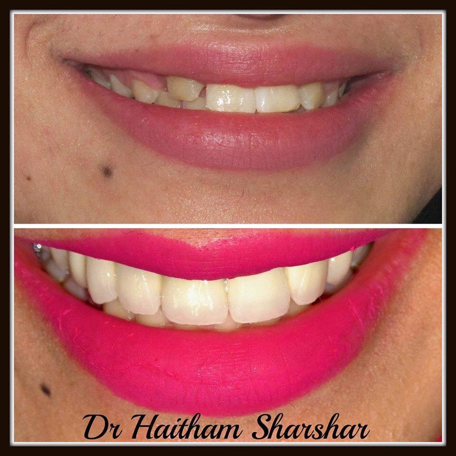 Bright Smile - Bright Smile