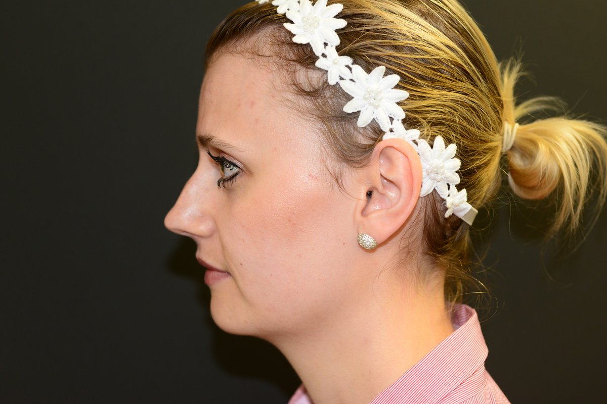 Bristol Cosmetic Surgery - Chesterfield Nuffield Hospital - Bristol Cosmetic Surgery - Chesterfield Nuffield Hospital