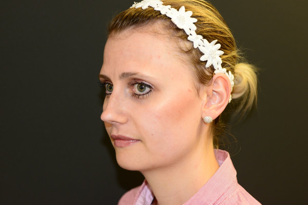 Bristol Cosmetic Surgery - Chesterfield Nuffield Hospital - Bristol Cosmetic Surgery - Chesterfield Nuffield Hospital