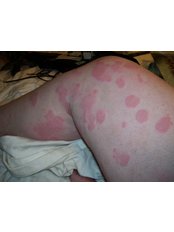 British Allergy Clinic - British Allergy Clinic