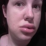 British Allergy Clinic - British Allergy Clinic