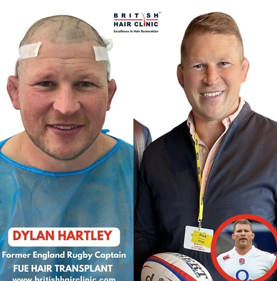 British Hair Clinic - British Hair Clinic