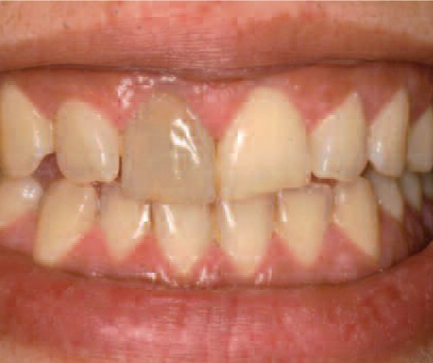 Brokos Clinic - Brokos Clinic