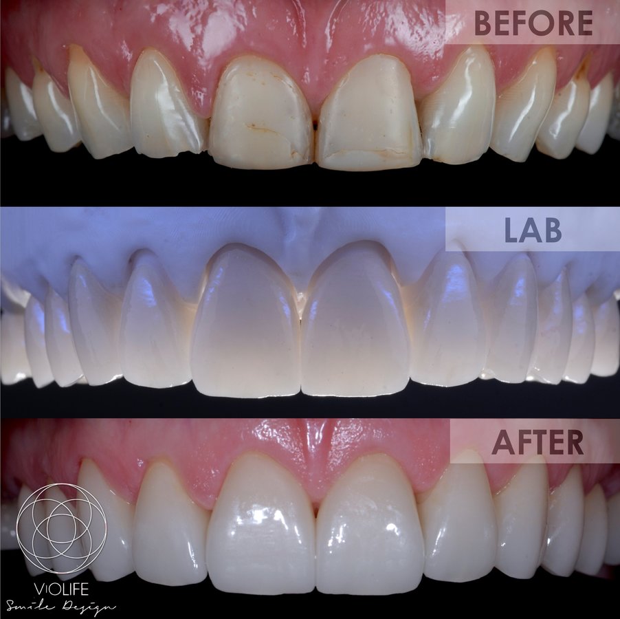 Cabinet Dentaire Dr. Violeta Bartalis ép. Claus - Cabinet Dentaire Dr. Violeta Bartalis ép. Claus