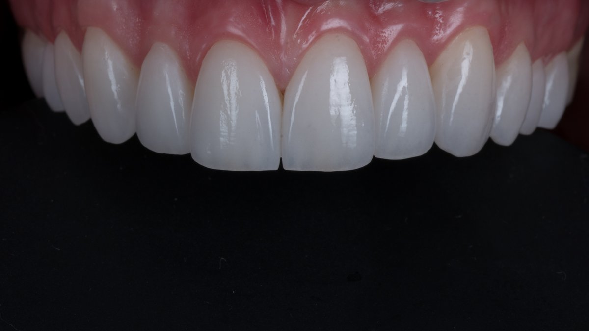 Cabinet Dentaire Dr. Violeta Bartalis ép. Claus - Cabinet Dentaire Dr. Violeta Bartalis ép. Claus