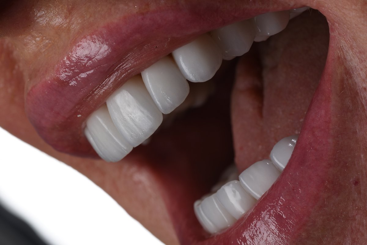 Cabinet Dentaire Dr. Violeta Bartalis ép. Claus - Cabinet Dentaire Dr. Violeta Bartalis ép. Claus