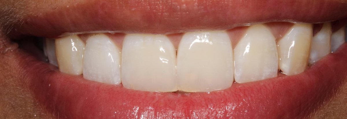 Cabinet d'Orthodontie Esthétique Dr. David Issembert - Cabinet d'Orthodontie Esthétique Dr. David Issembert