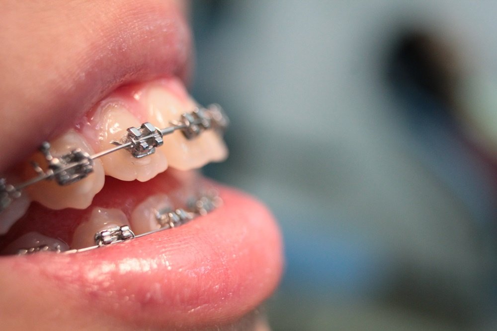 Cagaanan-Bangcong Dental Clinic - Cagaanan-Bangcong Dental Clinic