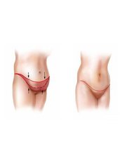 Cairo Slim Clinic - Cairo Slim Clinic