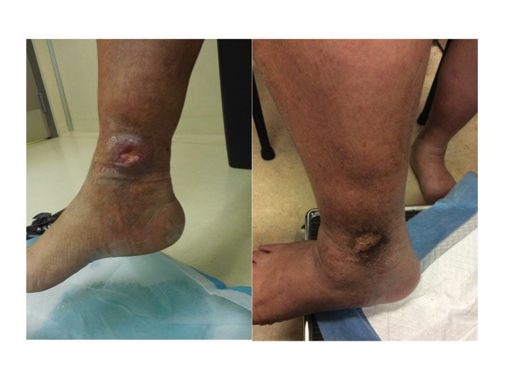 Canada Vein Clinics - Halifax - Canada Vein Clinics - Halifax