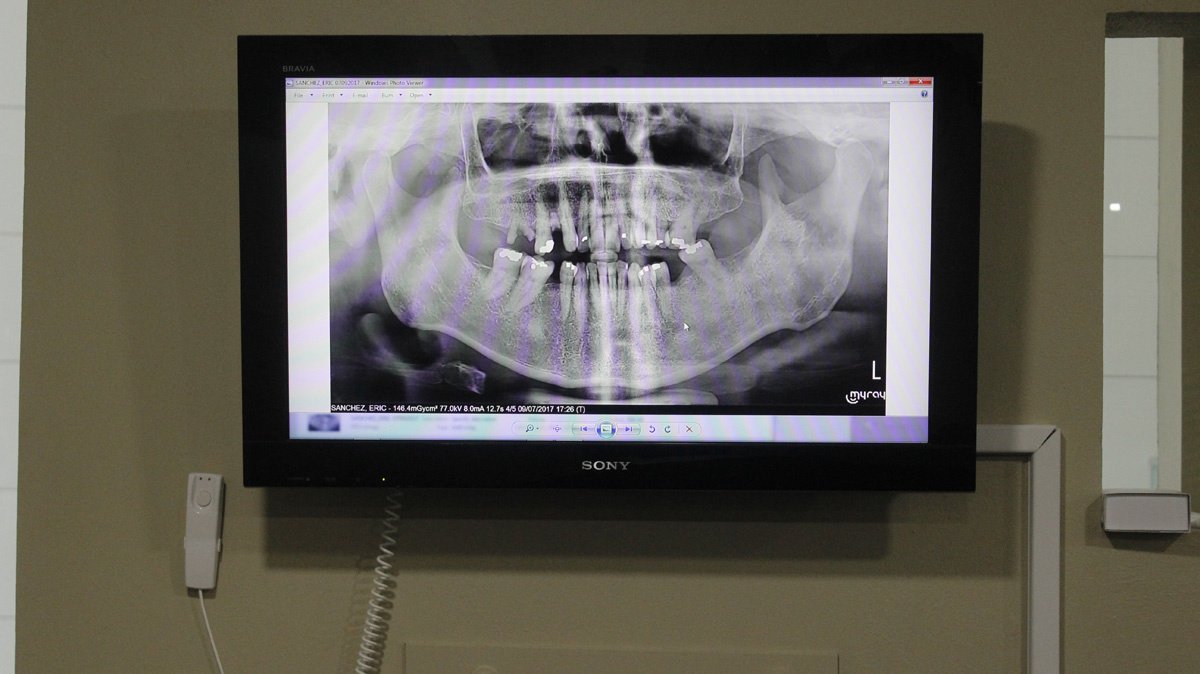 Cancun Cosmetic Dentistry - Cancun Cosmetic Dentistry