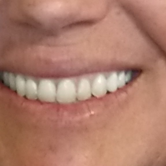 Cancun Cosmetic Dentistry - Cancun Cosmetic Dentistry