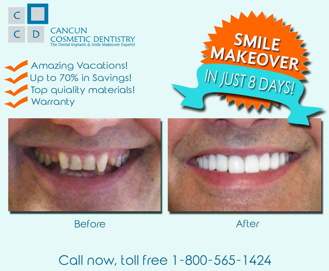 Cancun Cosmetic Dentistry - Cancun Cosmetic Dentistry