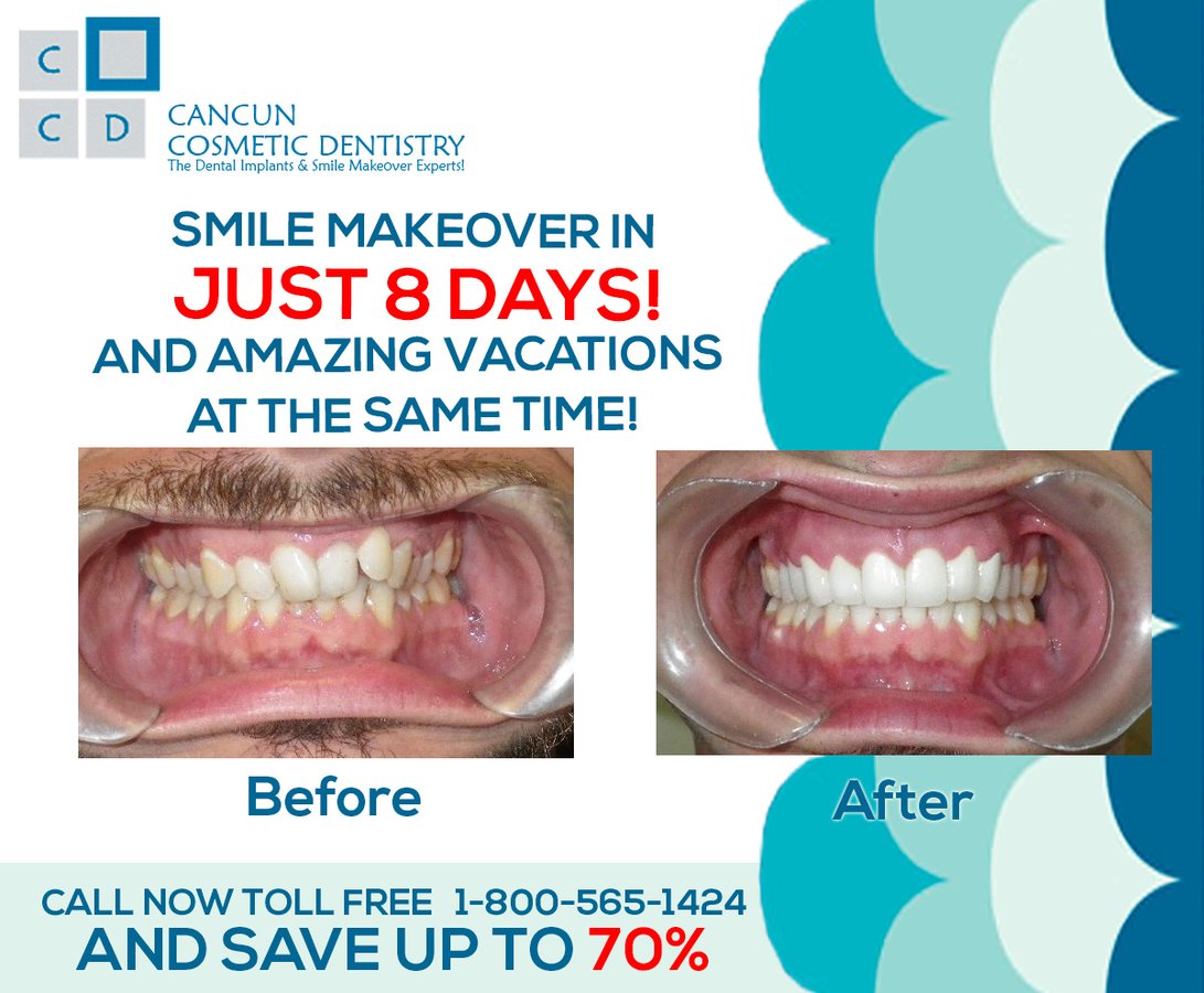 Cancun Cosmetic Dentistry - Cancun Cosmetic Dentistry
