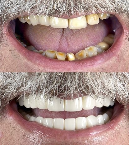 Cancun Dental Design - Cancun Dental Design