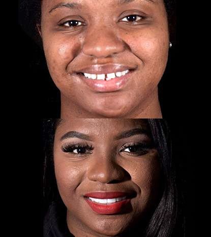 Cancun Dental Design - Cancun Dental Design