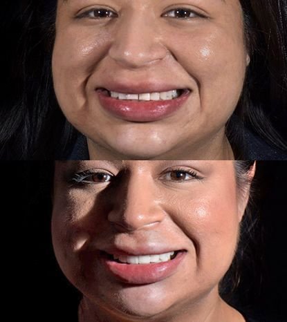 Cancun Dental Design - Cancun Dental Design