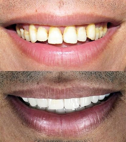 Cancun Dental Design - Cancun Dental Design