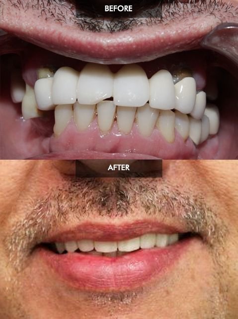 Cancun Dental Design - Cancun Dental Design