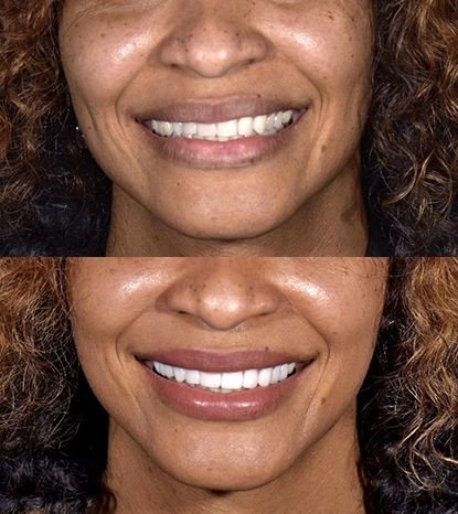 Cancun Dental Design - Cancun Dental Design