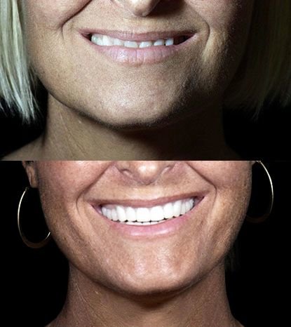 Cancun Dental Design - Cancun Dental Design