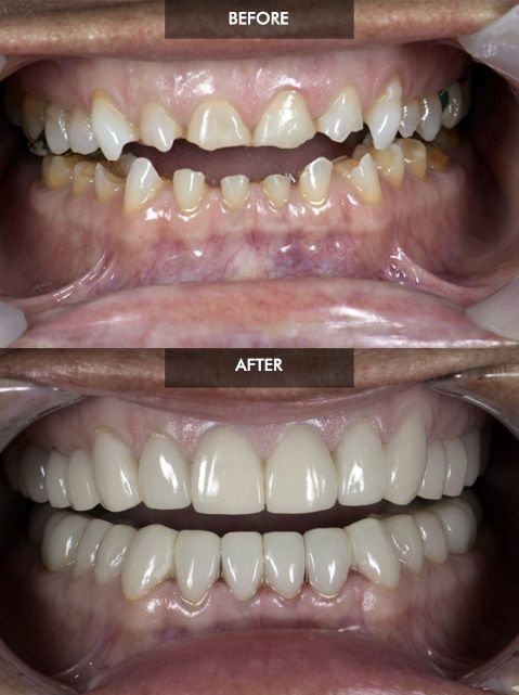 Cancun Dental Design - Cancun Dental Design