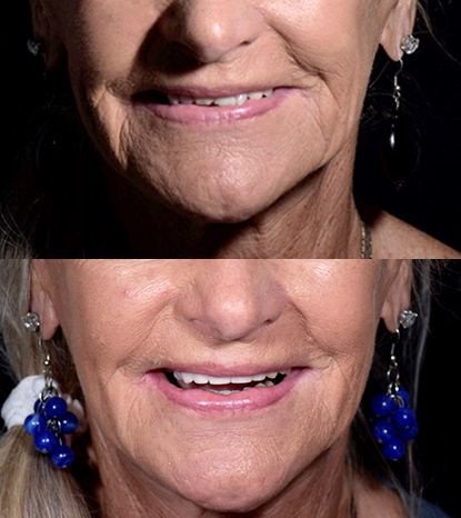 Cancun Dental Design - Cancun Dental Design