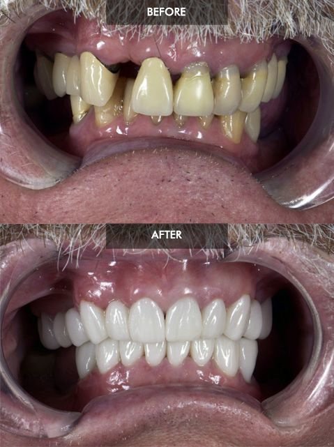 Cancun Dental Design - Cancun Dental Design