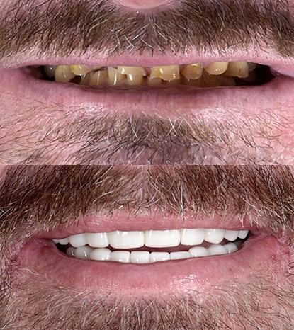 Cancun Dental Design - Cancun Dental Design