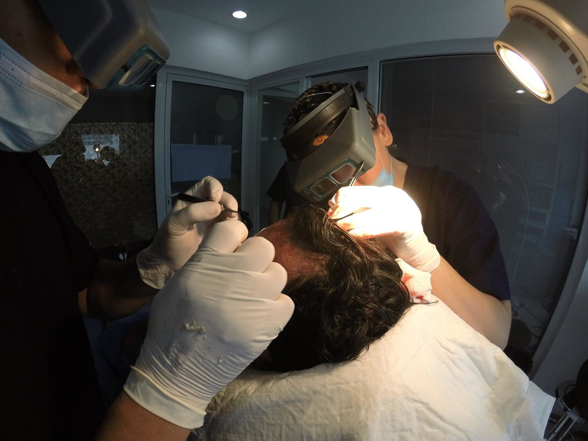 كانكون استعادة الشعر - Cancun Hair Restoration