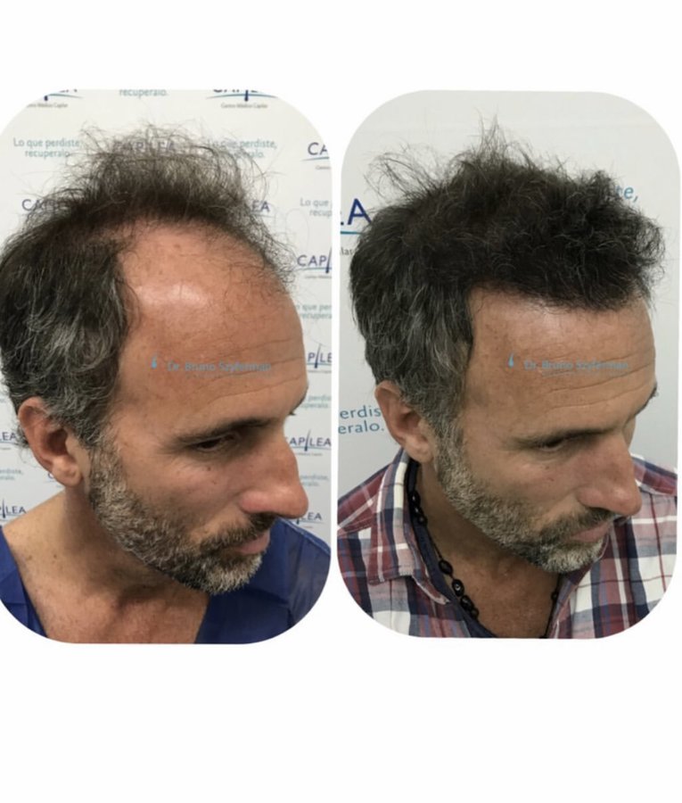 كابيليا سنترو ميديكو كابيلار - Capilea Centro Medico Capilar