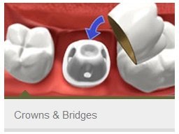 كابيتال لطب الأسنان - Capital Dentistry